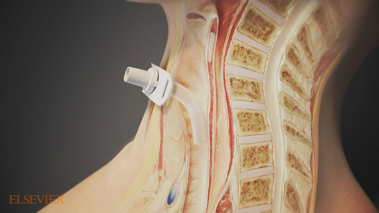 Medical Animation | 3D Animation Anatomy | Trinity Animation