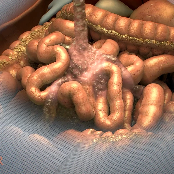 Trinity Animation Intestinal Supercut